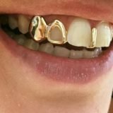 Teeth Grillz 1